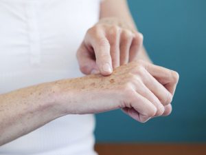 درمان لکه های پوستی روی دست