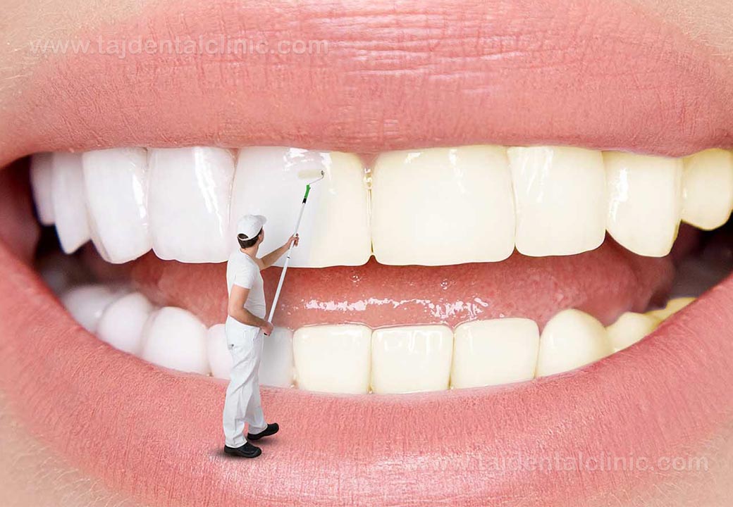 خمیر دندان کامپلت 10 میسویک