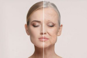 درمان چین و چروک صورت