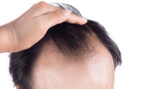 چه عواملی سبب تقویت مو و پر پشت شدن آن می شود؟